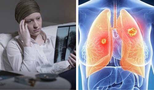 なぜ?女性の死亡率が増加している肺がん なぜ?女性の死亡率が増加している肺がん