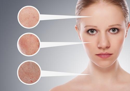 home-remedy-for-skin