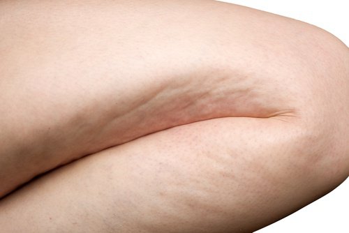 セルライト撃退に効果的なエクササイズ6選 セルライト撃退に効果的なエクササイズ6選