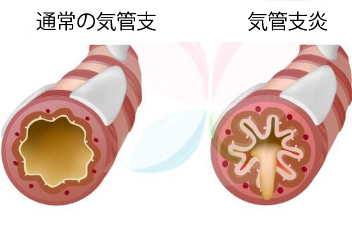喘息に良い食べ物10