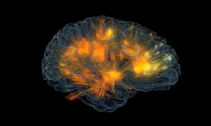 3-brain