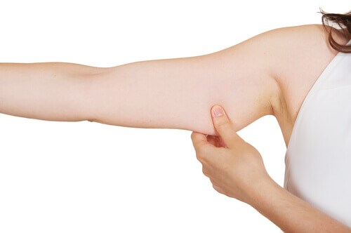 sagging-arms