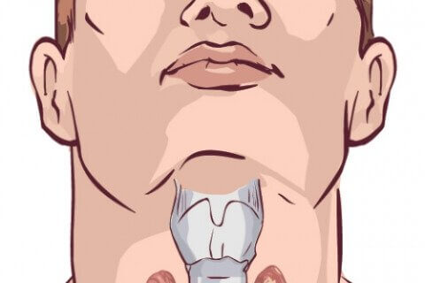 甲状腺の機能を高める自然療法