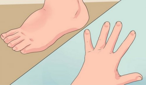 むくみを改善するための5つのヒント むくみを改善するための5つのヒント