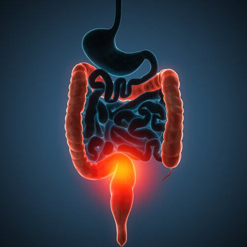 Colon-cleaning kecchou