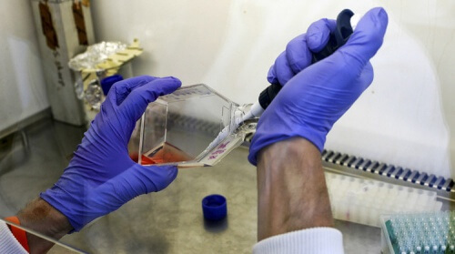 ラボ 骨髄ドナー