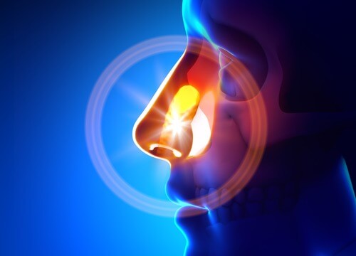 自然のもので副鼻腔炎を治す方法 自然のもので副鼻腔炎を治す方法