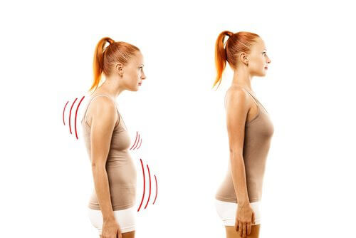 fix-posture-2-500x334