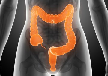 過敏性腸