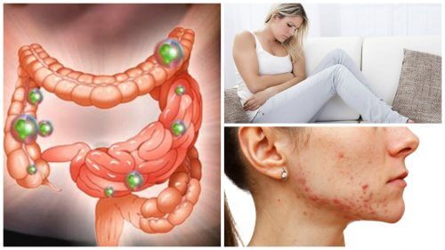 腸内細菌が制御不能になっているときに起こる6つの問題 腸内細菌が制御不能になっているときに起こる6つの問題