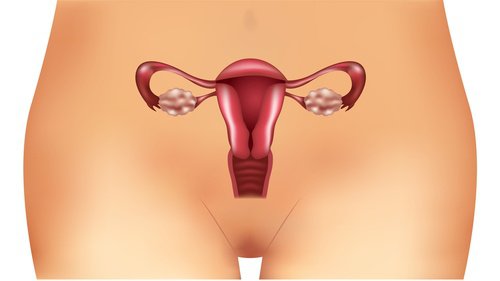 あまり知られていない病気:多嚢胞性卵巣症候群とは?