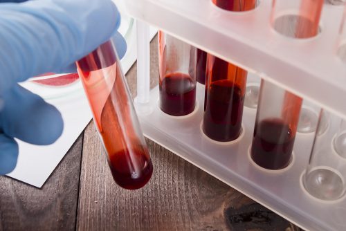 ガンの早期発見につながる血液検査