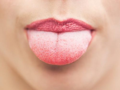 舌から分かる９つの健康状態