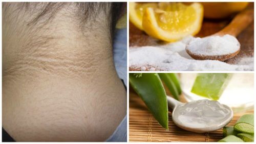 首周りに出来た黒ずみを薄くする/5つのスキンケア