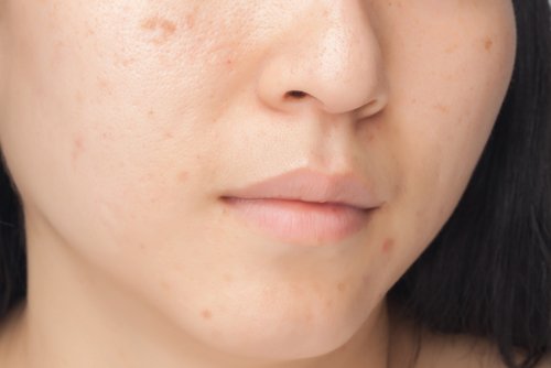 お肌にダメージを与える7つの食習慣 お肌にダメージを与える7つの食習慣