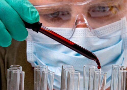 腫瘍の場所がわかるシンプルな血液検査 腫瘍の場所がわかるシンプルな血液検査