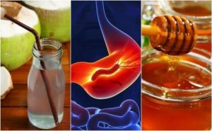 胃炎に効果抜群の自然療法
