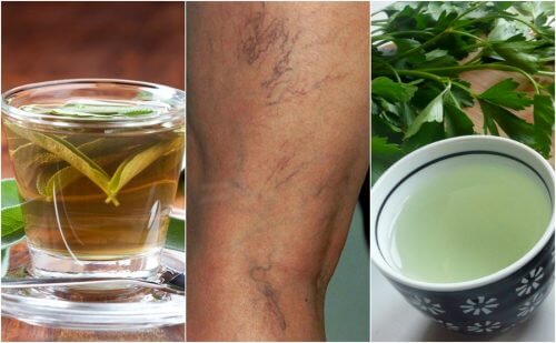 静脈瘤に効果抜群!利尿作用の高いお茶5選 静脈瘤に効果抜群!利尿作用の高いお茶5選