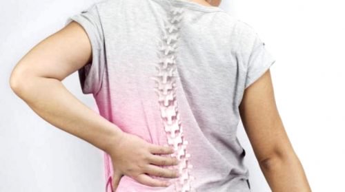 女性に多い：脊柱側弯症