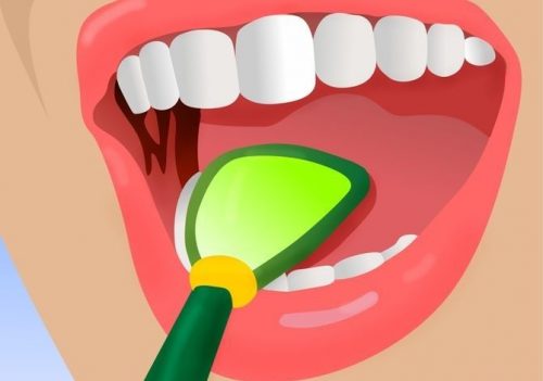 口臭を解消する5つのコツ 口臭を解消する5つのコツ