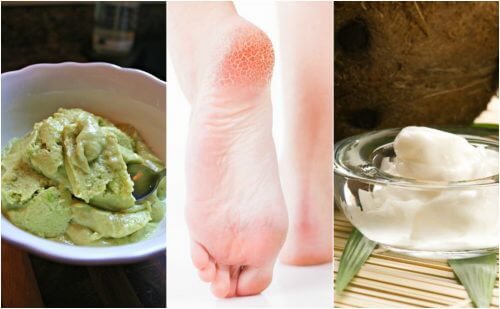 かかとのひび割れに悩んでいませんか? 試してほしい自然療法5つ かかとのひび割れに悩んでいませんか? 試してほしい自然療法5つ