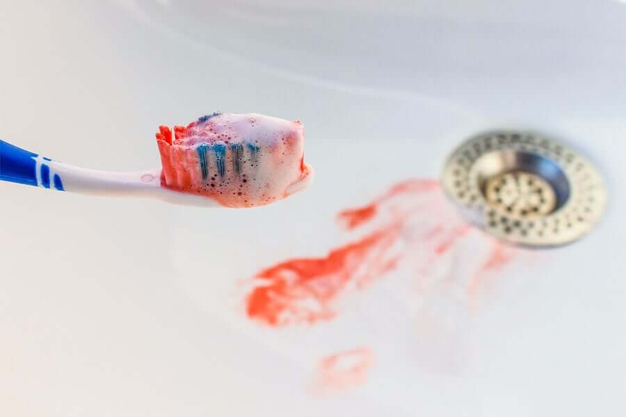 歯磨きで出血