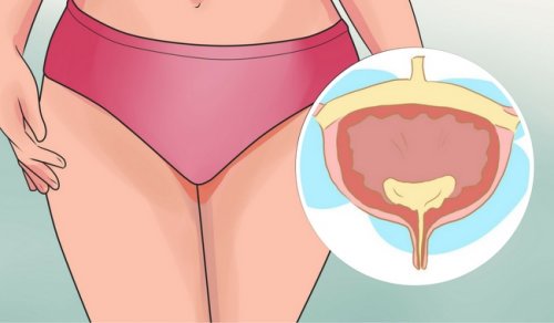 過活動膀胱の患者が避けるべき食品