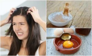 フケを自然になくす5つの自宅療法