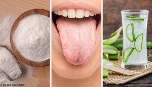 白くなった舌に効果的な７つの自然療法