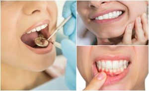 歯性感染症かも！？歯性感染症を示す7つの症状