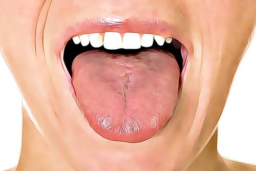 舌の口内炎に効く6つの自宅療法
