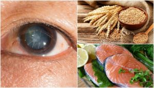 白内障のリスクを軽減する７つの食べ物