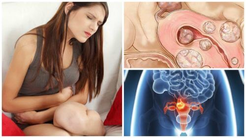 すべての女性に知ってほしい!子宮筋腫の真実5選