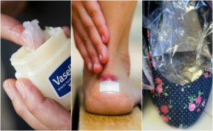 靴擦れでマメができないようにする解決法7選