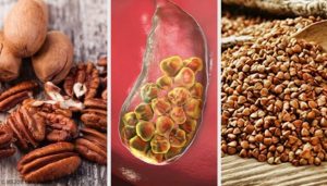 胆石と闘うのに役立つ食べ物6選