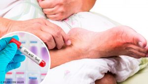 尿酸値が高くなる5つの原因