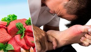 尿酸値を上げてしまう7つの食べ物