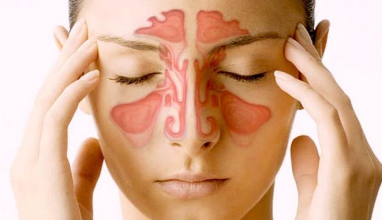 副鼻腔について知っておくべき5つのこと