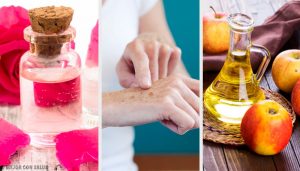 手の美白に! 8つの自然療法