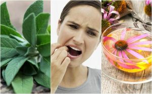 歯肉炎を治す5つの自然療法