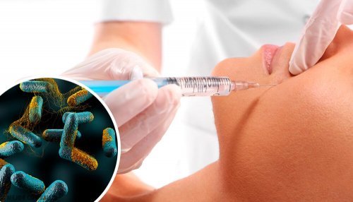 ボツリヌストキシン:死をもたらす毒