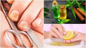 爪水虫退治&爪の強化:5つの秘訣