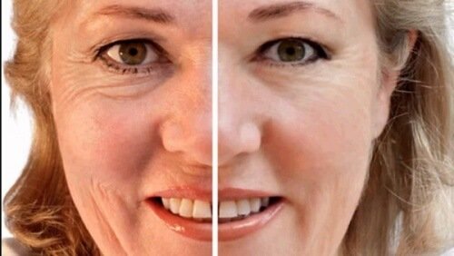 シワのある顔とない顔