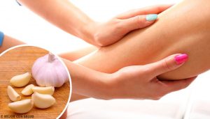 体液貯留に効果的な自然療法