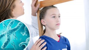 ターナー症候群について知っておくべきすべてのこと