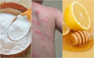 ノミ刺されに効果的な家でも出来る5つ解消法