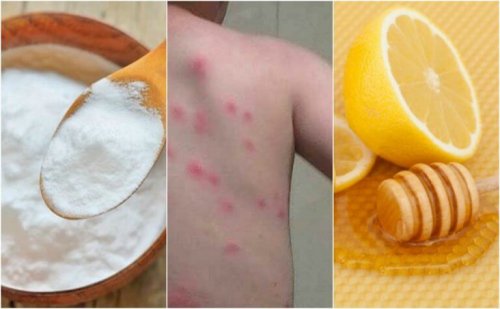 ノミ刺されに効果的な家でも出来る5つ解消法