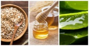 脂漏性湿疹に効果的な自然療法