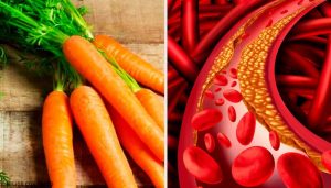 コレステロールを正常に保つシンプルで自然な方法