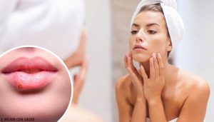 健康問題を抱えているかも?顔に現れる13のサイン